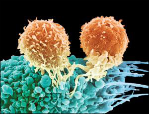 Новая технология лечения позволяет &laquo;научить&raquo; иммунные Т-клетки атаковать клетки опухоли. Подобная методика, теоретически, может применяться для лечения любых видов рака на любой стадии, а также многих инфекционных заболеваний и тяжелых отравлений