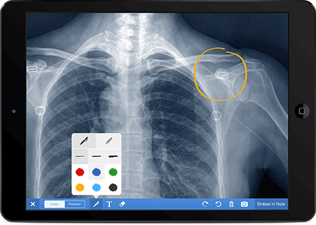 Рентгеновские снимки благодаря Drchrono можно рассматривать на планшете
