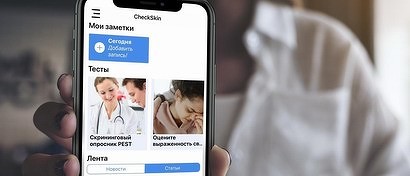 В России создан бесплатный «мобильный доктор» для людей с кожными заболеваниями